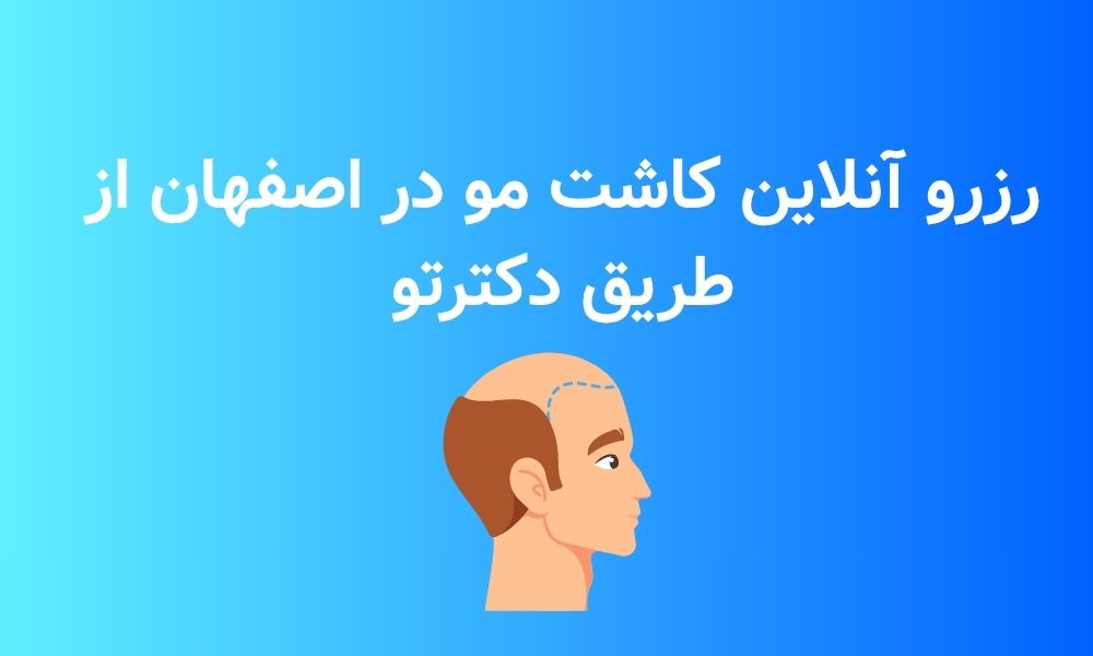 کلینیک کاشت مو در اصفهان